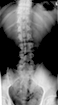 spinal injuries.jpg