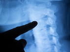 spinal_condition_1.png
