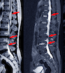 spinal_condition_5.png
